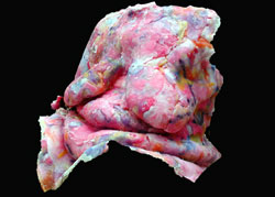 "Layers of Protection"